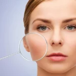 Physio Radiance Series: Understanding Your Skin Type