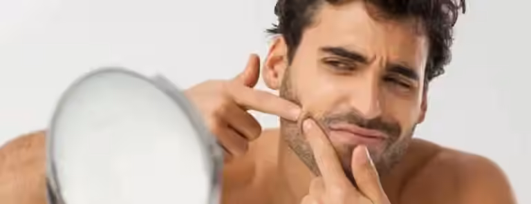 What Are Your Persistent Pimples Telling You About Your Health?