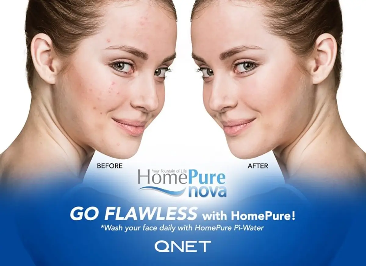 QNET